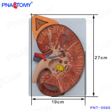 Modelo de rim PNT-0560cc com glândula adrenal, modelo médico de anatomia renal